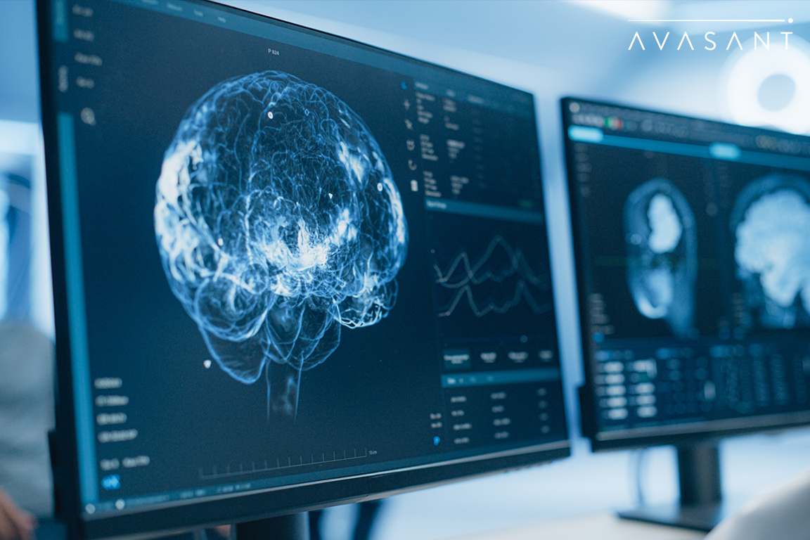 Telepathy-Based Computing: The Race to Own the Next AI Interface